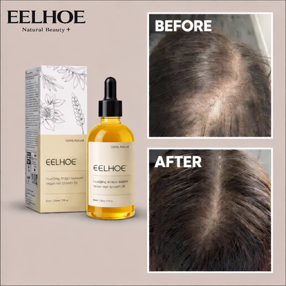 EELHOE Rosemary Hair Growth Essential Oil